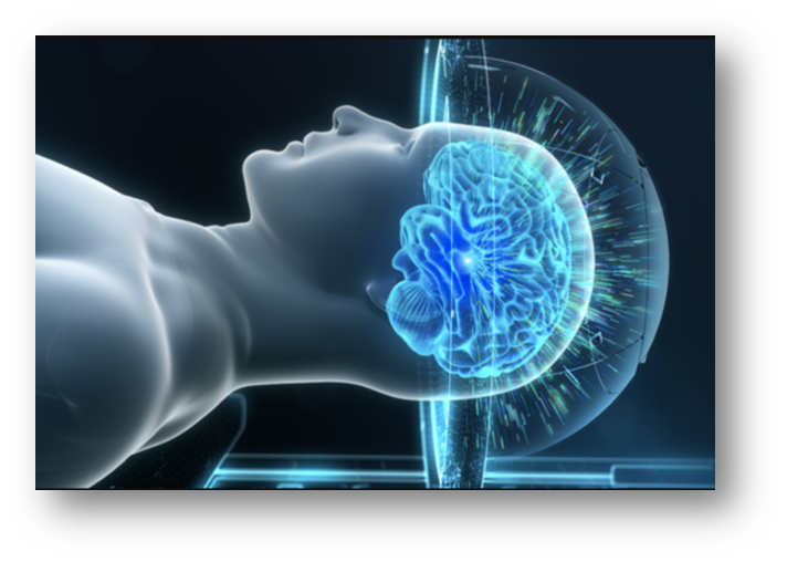 Image of brain