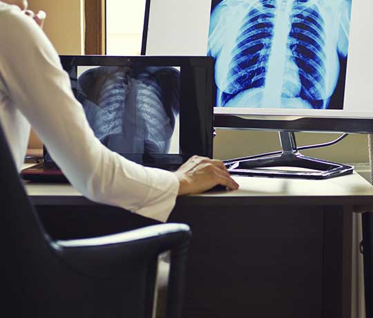 Doctor looking at chest x-ray image