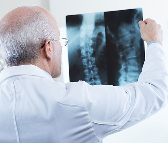 Physician looking at x-ray of a spine