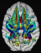 brainscan