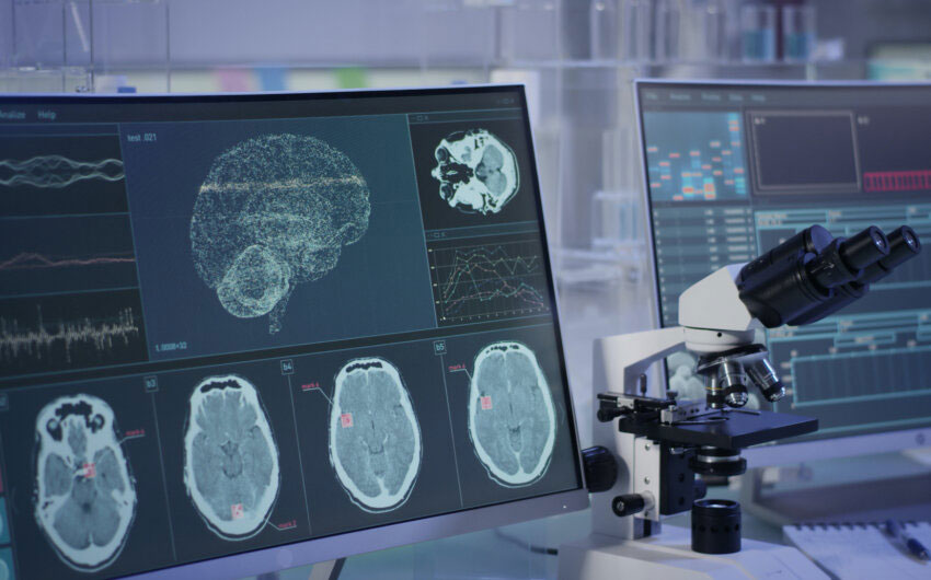 monitors showing brain scan images in xray along side a microscope at a desk  setting