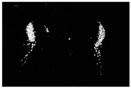 Neuroendocrinology