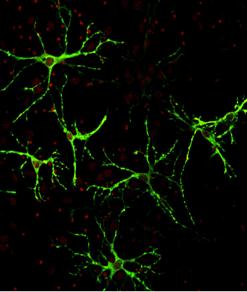 synapse2