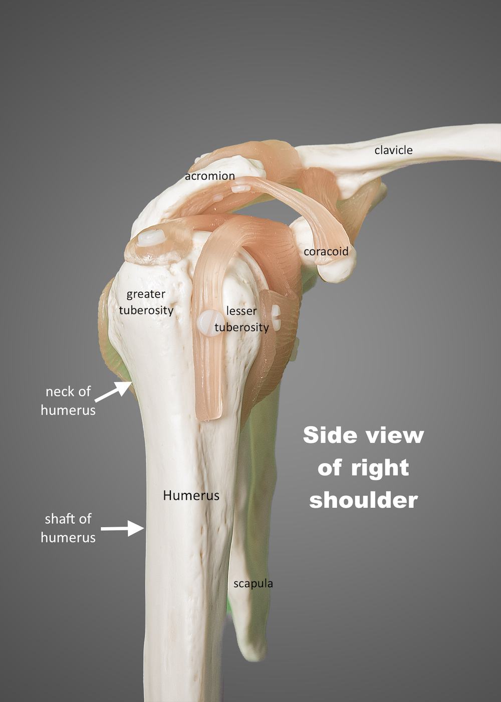 shoulder view