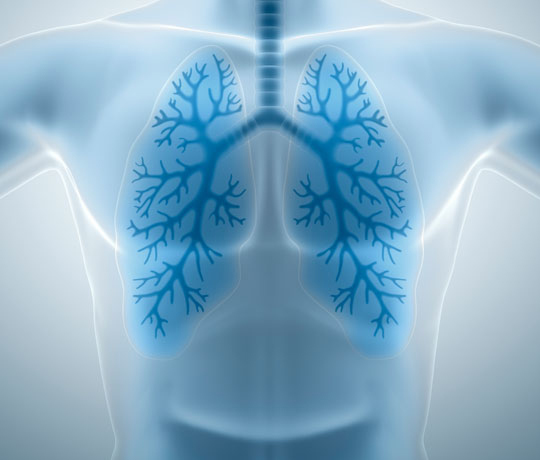 X-ray image of lungs