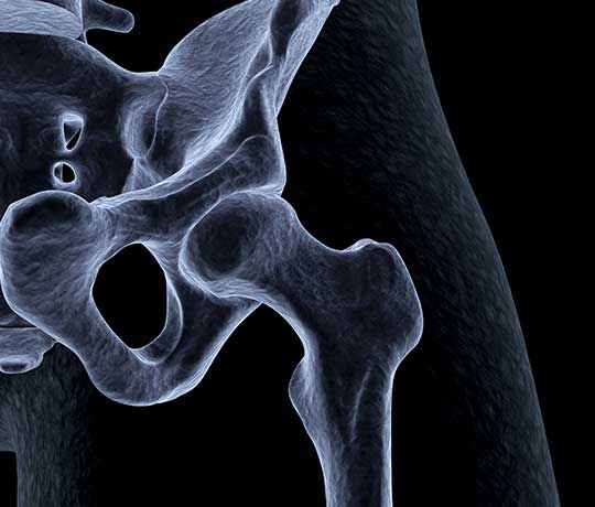 X-ray image of hip