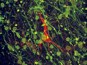 Astrocytes