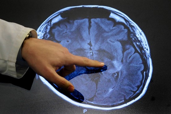 Brain Scan