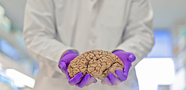 Biggs Institute doctor holding a brain