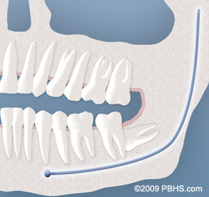 complete bone - UT Dentistry - San Antonio