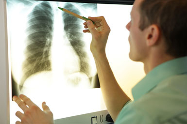 Pulmonlogist looking at x-ray image of lungs