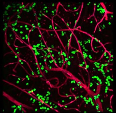 Proliferating adult neural stem cells near the niche vasculature