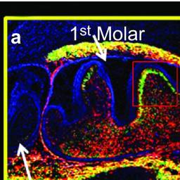 molar image