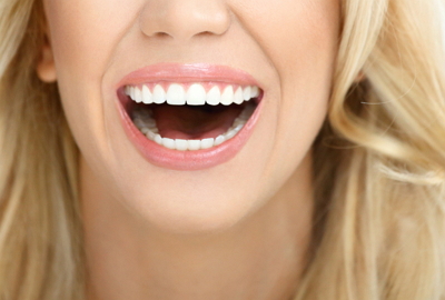 Dental Veneers 